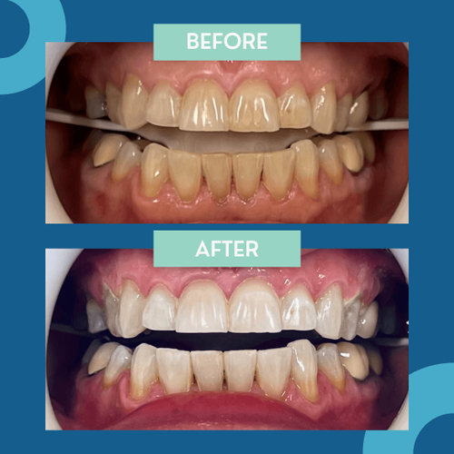 Dentist in Menomonee Falls Riverside Family Dental